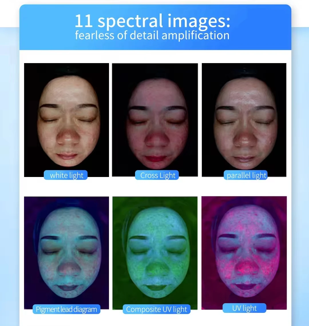 Upgraded X5 3D Ai Skin Image Analyzer High Definition Pixels Whole Facial Scanning Multi Spectrum Moisture Scalp Detection
Upgraded X5 3D Ai Skin Image Analyzer High Definition Pixels Whole Facial Scanning Multi Spectrum Moisture Scalp Detection