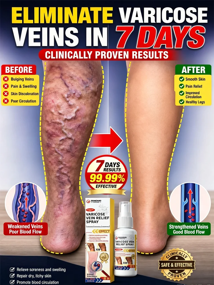 7 Days Effective Varicose Veins Treatment Spray for Leg Care
7 Days Effective Varicose Veins Treatment Spray for Leg Care