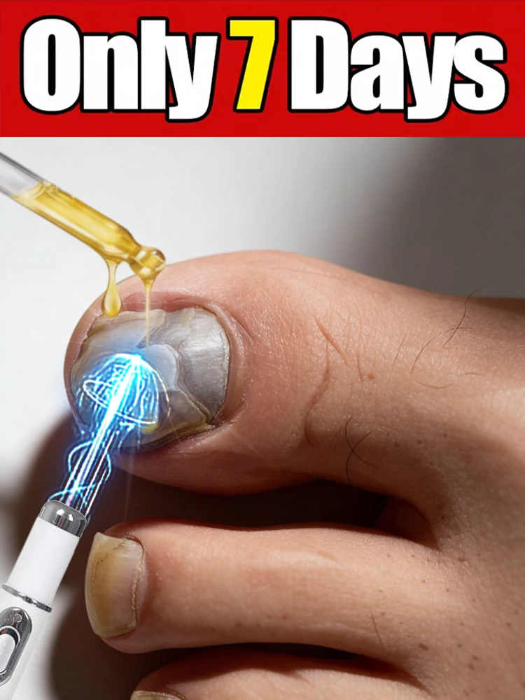 Fifth-generation champagne-colored nail laser pen, ꜱᴀʏ ɢᴏᴏᴅʙʏᴇ ᴛᴏ ʙᴀᴅ ɴᴀɪʟꜱ
Fifth-generation champagne-colored nail laser pen, ꜱᴀʏ ɢᴏᴏᴅʙʏᴇ ᴛᴏ ʙᴀᴅ ɴᴀɪʟꜱ