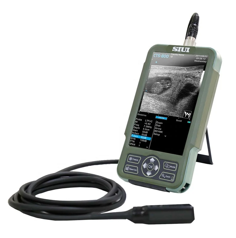 Best Quality Promotional SIUI CTS-800 Veterinary Use B/W Ultrasound Scanner High Quality Ultrasound Machine Scanner for Vet
Best Quality Promotional SIUI CTS-800 Veterinary Use B/W Ultrasound Scanner High Quality Ultrasound Machine Scanner for Vet