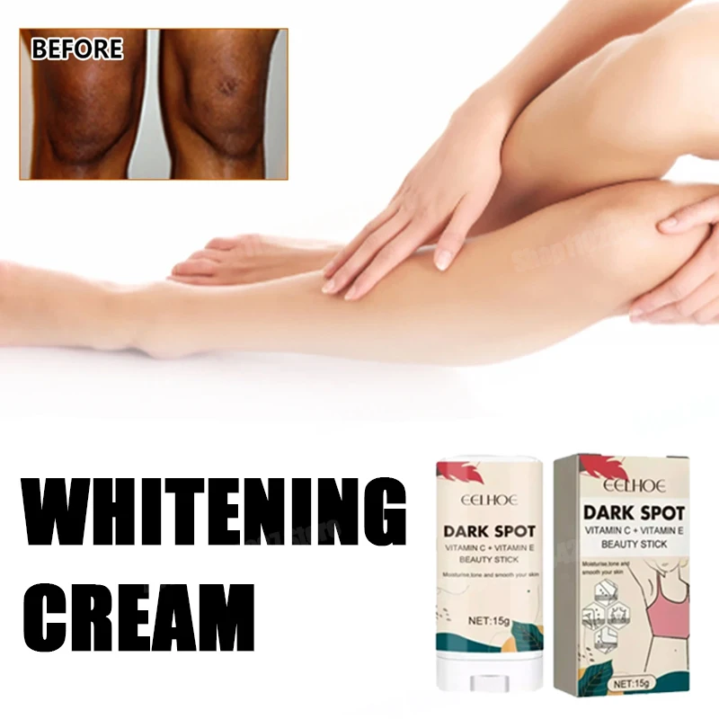 Buttocks Armpit Whitening Essence for Melanin Removal on Hip Knee Thigh Inner Skin Brightening Private Parts Serum
Buttocks Armpit Whitening Essence for Melanin Removal on Hip Knee Thigh Inner Skin Brightening Private Parts Serum