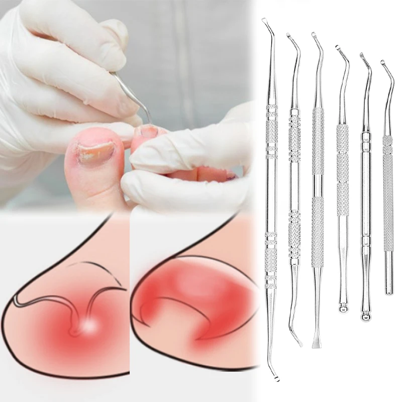 6Pcs Ingrown Toenail Correction Tool Set Stainless Steel Double-Ended Nail Files Paronychia Care Foot Cleaning Tools
6Pcs Ingrown Toenail Correction Tool Set Stainless Steel Double-Ended Nail Files Paronychia Care Foot Cleaning Tools