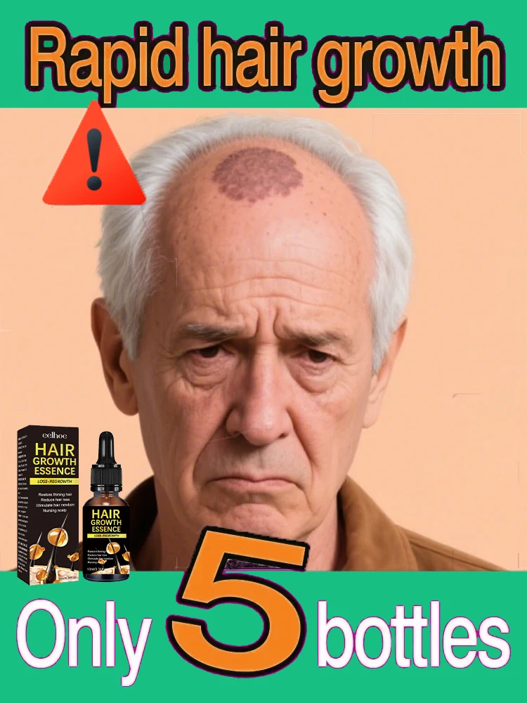 Fast Hair Growth Oil Baldness Repair Hereditary Hair Loss Postpartum Seborrheic Hair Loss Oil
Fast Hair Growth Oil Baldness Repair Hereditary Hair Loss Postpartum Seborrheic Hair Loss Oil