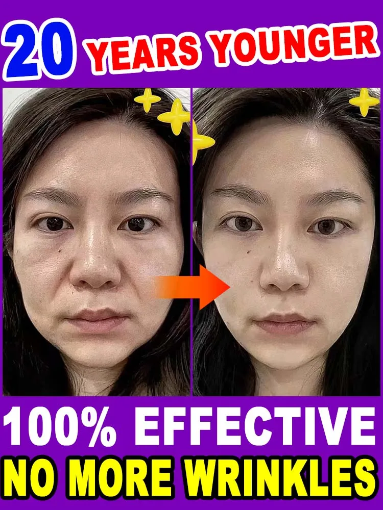 Идеальная кожа, ручная коррекция возраста. Для морщин, мелких линий, линий шеи.
Идеальная кожа, ручная коррекция возраста. Для морщин, мелких линий, линий шеи.