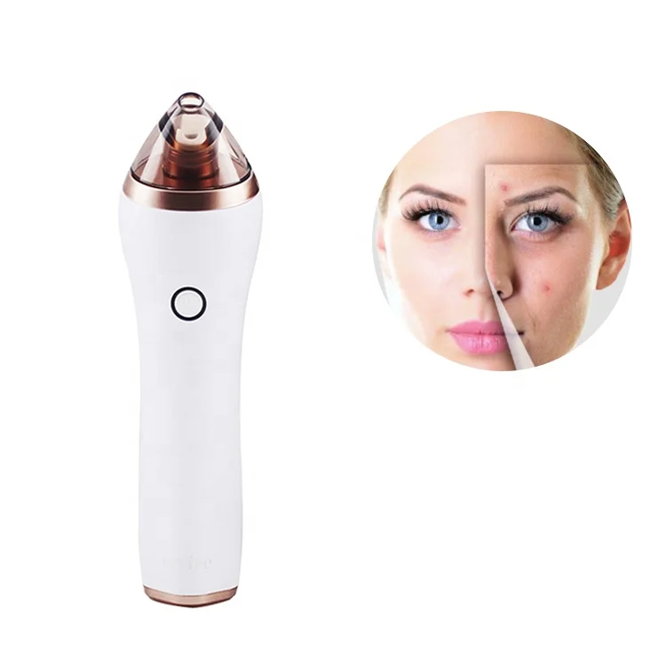 Facial Deep Clean Acne Comedone Zit Pimple Extractor Electric Blackhead Remover Pore Vacuum
Facial Deep Clean Acne Comedone Zit Pimple Extractor Electric Blackhead Remover Pore Vacuum