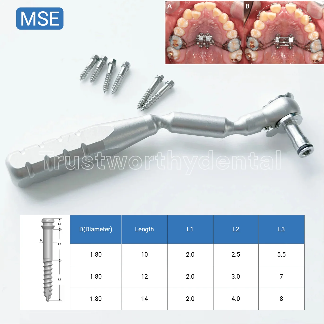 Dental MSE Wrench Screw Driver Handle Ratchet Wrench Maxillary Skeletal Expander Fits BMK
Dental MSE Wrench Screw Driver Handle Ratchet Wrench Maxillary Skeletal Expander Fits BMK
