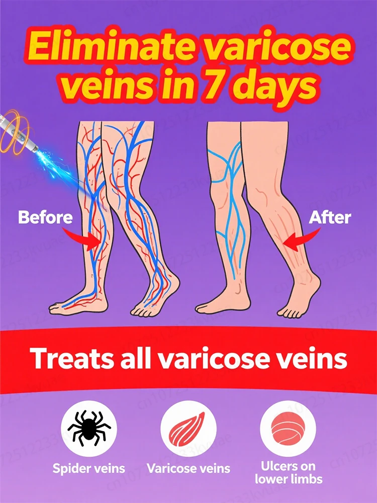 Generation-8 Laser Says Goodbye To Spider Legs Varicose In 3 Days
Generation-8 Laser Says Goodbye To Spider Legs Varicose In 3 Days