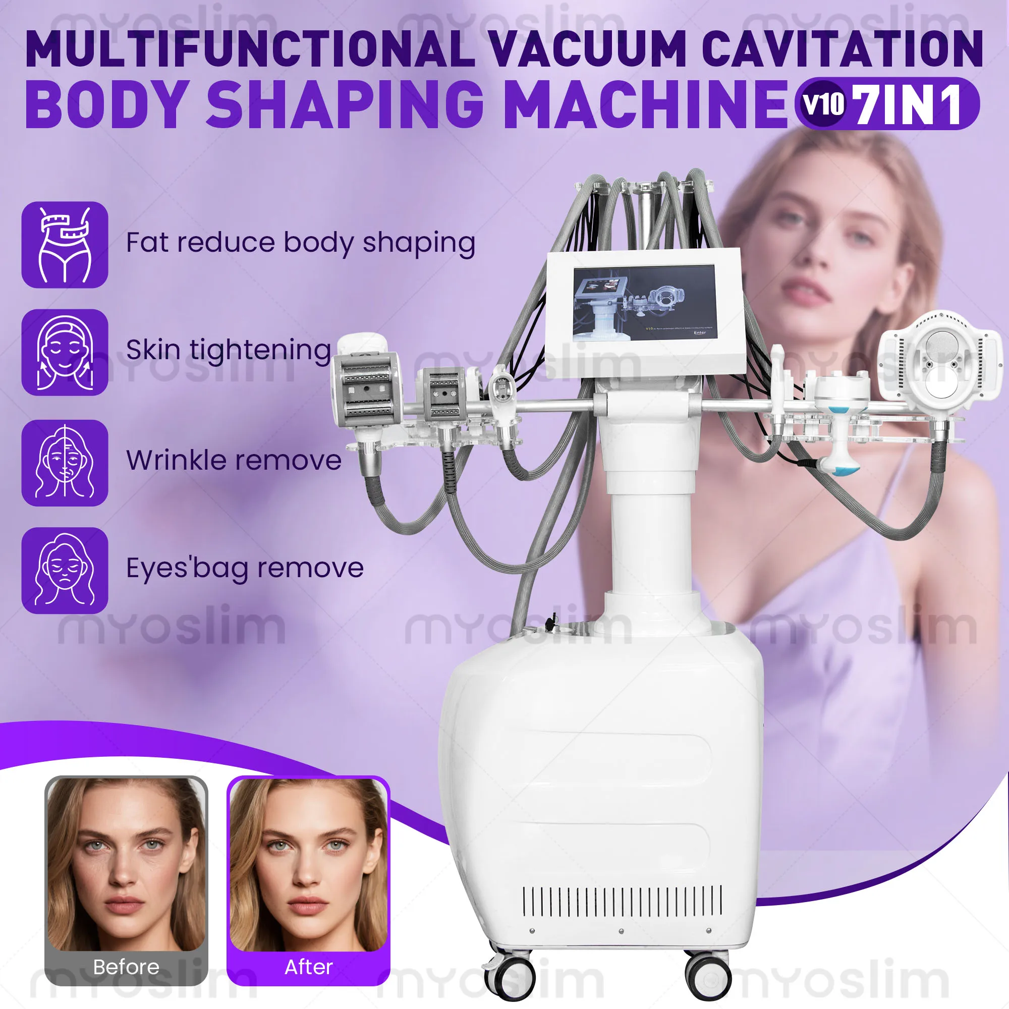 V10 Multifunctional VELABODY Shape Body Slimming Cavitation Cellulite Fat Removal Vacuum Roller eye care Weight loss machine
V10 Multifunctional VELABODY Shape Body Slimming Cavitation Cellulite Fat Removal Vacuum Roller eye care Weight loss machine