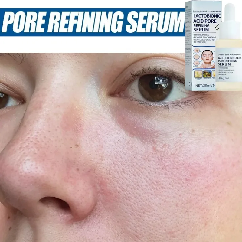 Face Serum for Minimizing Pores and Smoothing Skin Care; Pore Repairing Essence Tightening and Beauty Serum
Face Serum for Minimizing Pores and Smoothing Skin Care; Pore Repairing Essence Tightening and Beauty Serum