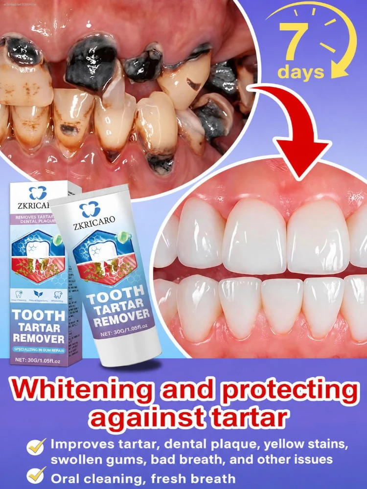 Hydroxyapatite toothpaste effectively combats tartar, promotes enamel re-strengthening, deeply removes plaque, protects gums, and addresses issues such as swollen gums and bad breath. It provides professional oral hygiene, fresh breath, and overall care.
Hydroxyapatite toothpaste effectively combats tartar, promotes enamel re-strengthening, deeply removes plaque, protects gums, and addresses issues such as swollen gums and bad breath. It provides professional oral hygiene, fresh breath, and overall care.
