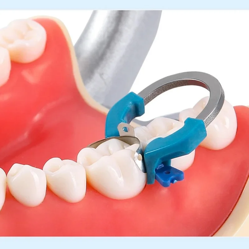 Зажимное кольцо VVDental Dentist NITI, стоматологические инструменты, металлические матрицы + зажимное кольцо NITI, стоматологические инструменты, стоматологические лабораторные инструменты
Зажимное кольцо VVDental Dentist NITI, стоматологические инструменты, металлические матрицы + зажимное кольцо NITI, стоматологические инструменты, стоматологические лабораторные инструменты