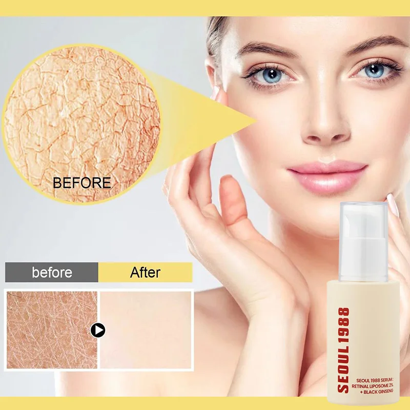 Seoul 1988 Retinal Serum Face Serum skincare Moisturizing Skin Brightening Rejuvenation Moisturizing Anti-aging Korean Skin Care
Seoul 1988 Retinal Serum Face Serum skincare Moisturizing Skin Brightening Rejuvenation Moisturizing Anti-aging Korean Skin Care