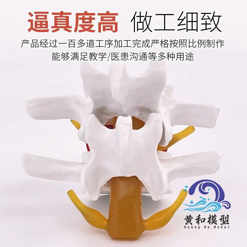 Lumbar Enlargement Lumbar Disc Compression Demonstration Model Simulation Spine Vertebral Pathology Demonstration Joint Medical
Lumbar Enlargement Lumbar Disc Compression Demonstration Model Simulation Spine Vertebral Pathology Demonstration Joint Medical
