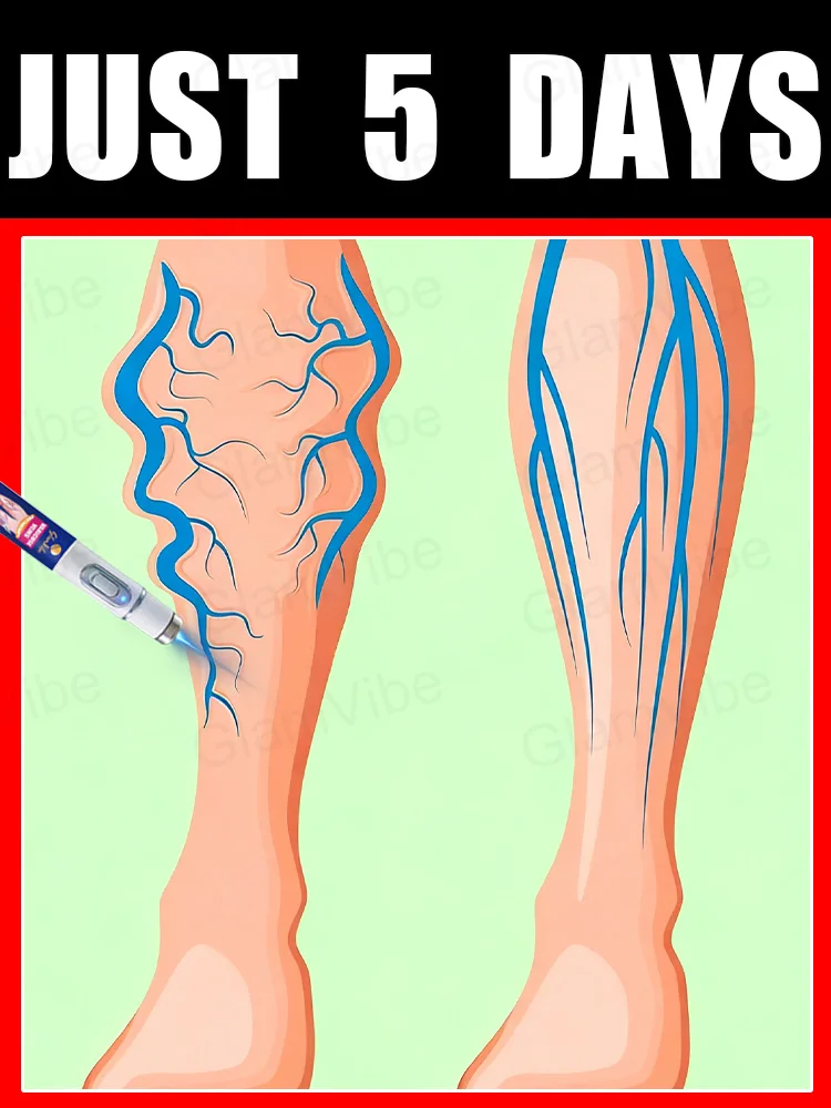 blue light pen solve varicose veins, hot sale leg care tools
blue light pen solve varicose veins, hot sale leg care tools