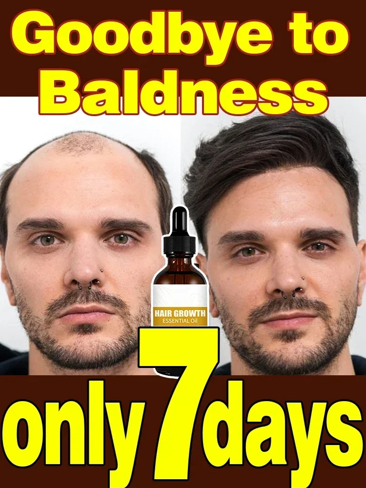 Unisex Rapid Hair Growth Oil: Effective Treatment for Baldness, Hereditary Hair Loss & Postpartum Recovery
Unisex Rapid Hair Growth Oil: Effective Treatment for Baldness, Hereditary Hair Loss & Postpartum Recovery