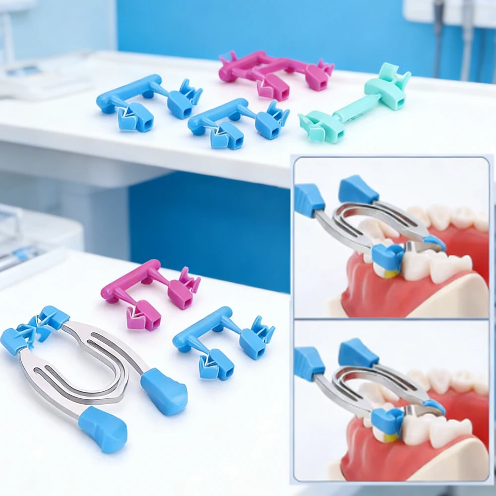 Dental Matrix Sectional Contoured Matrices with Wedges Clamps Metal Spring Clip Rings Dentist Tools
Dental Matrix Sectional Contoured Matrices with Wedges Clamps Metal Spring Clip Rings Dentist Tools