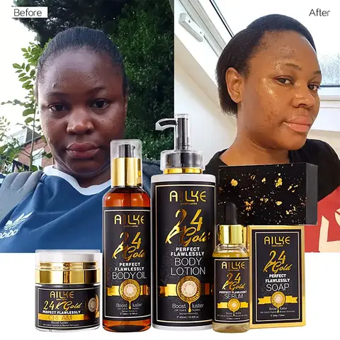AILKE 24k Gold Flawlessly Whitening Skin Care Set For All Skin Type, Moisturizer, Reduce Black Spots, Smoothing, Brightening