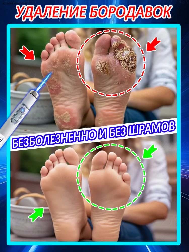 Настоящая находка для людей с бородавками! Удобен в использовании.
Настоящая находка для людей с бородавками! Удобен в использовании.