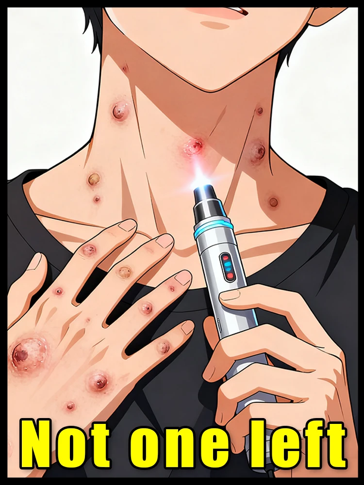 Средства по уходу за гладкой кожей, рассказывайте бородавки.
Средства по уходу за гладкой кожей, рассказывайте бородавки.