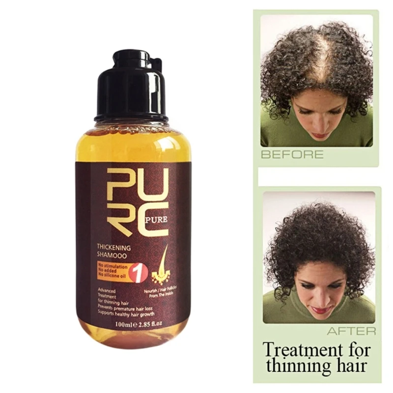 Q1QD Hair Shampoo Care Anti-dandruff Anti-Dandruff Antihair Loss Moisturizing Refreshing Oil Control Clogging Follicle
Q1QD Hair Shampoo Care Anti-dandruff Anti-Dandruff Antihair Loss Moisturizing Refreshing Oil Control Clogging Follicle