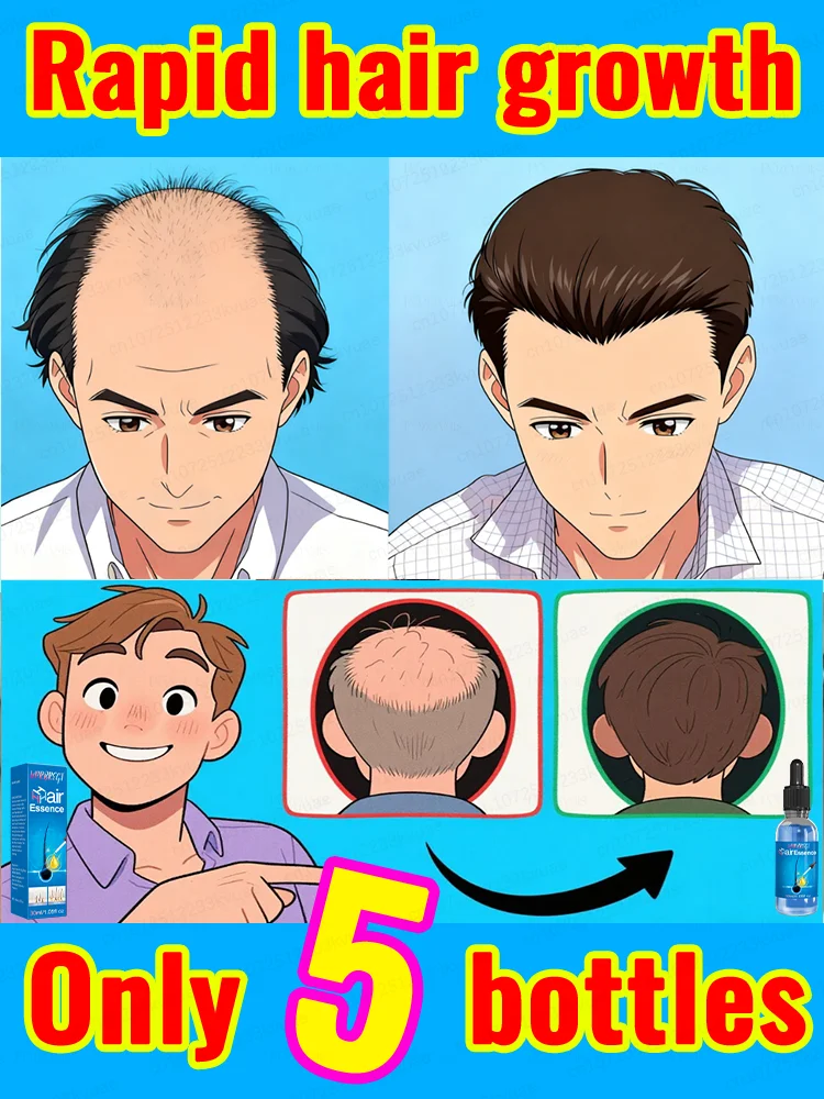 ᴴᵉʳᵇᵃˡ ʰᵃⁱʳ ɢʀᴏᴡᴛʜ ᴏɪʟ ᴘʀᴇᴠᴇɴᴛs ʰᵃⁱʳ loss and helps ᴡɪᴛʜ ʀᴇᴄᴇᴅɪɴɢ ʜᴀɪʀʟɪɴᴇs...
ᴴᵉʳᵇᵃˡ ʰᵃⁱʳ ɢʀᴏᴡᴛʜ ᴏɪʟ ᴘʀᴇᴠᴇɴᴛs ʰᵃⁱʳ loss and helps ᴡɪᴛʜ ʀᴇᴄᴇᴅɪɴɢ ʜᴀɪʀʟɪɴᴇs...