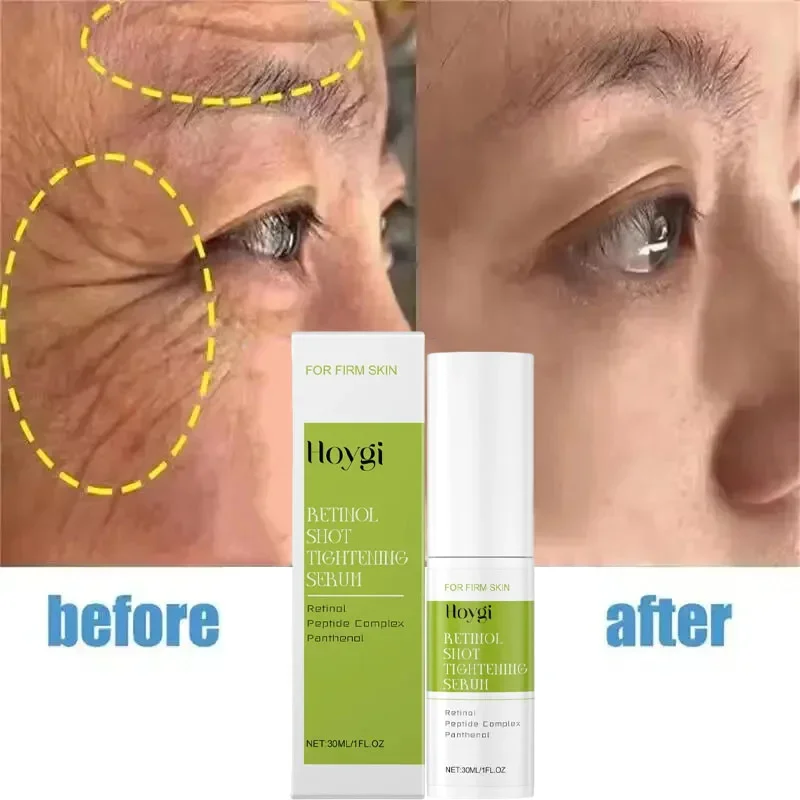 100% Natural Retinol Facial Serum Anti Wrinkle Aging Reduce Fine Lines Rejuvenating Face Lifting Moisturizing Korean Cosmetics
100% Natural Retinol Facial Serum Anti Wrinkle Aging Reduce Fine Lines Rejuvenating Face Lifting Moisturizing Korean Cosmetics