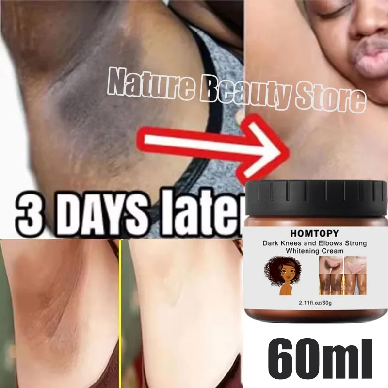 Whitening Cream Private Parts Underarm Bleaching Serum Whiten Butt Knee Brighten Inner Thigh Intimate Parts Dark Remove Melanin
Whitening Cream Private Parts Underarm Bleaching Serum Whiten Butt Knee Brighten Inner Thigh Intimate Parts Dark Remove Melanin