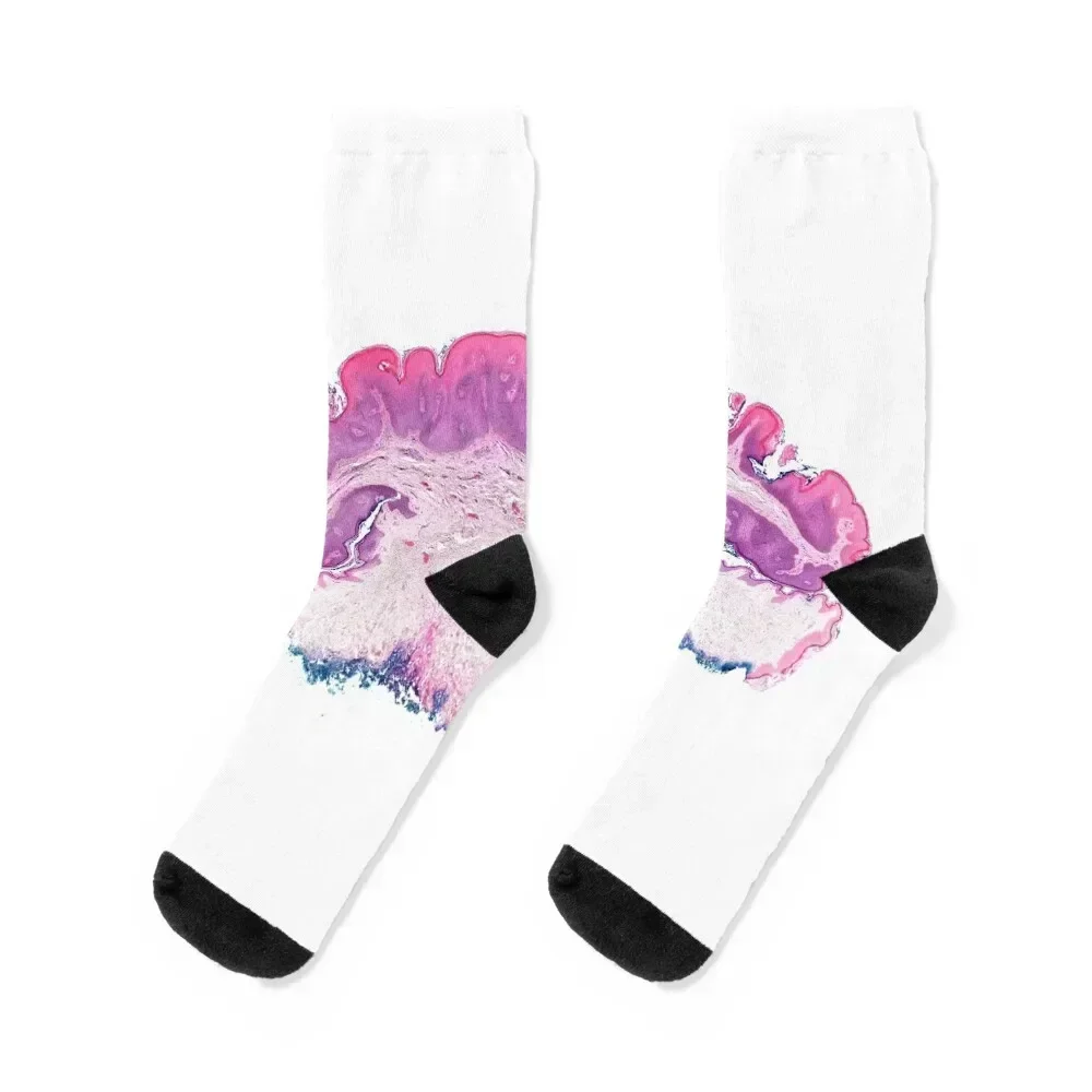 Seborrhoeic keratosis, light micrograph (C024/8141) Socks halloween compression winter thermal bright garter Socks Ladies Men's
Seborrhoeic keratosis, light micrograph (C024/8141) Socks halloween compression winter thermal bright garter Socks Ladies Men's