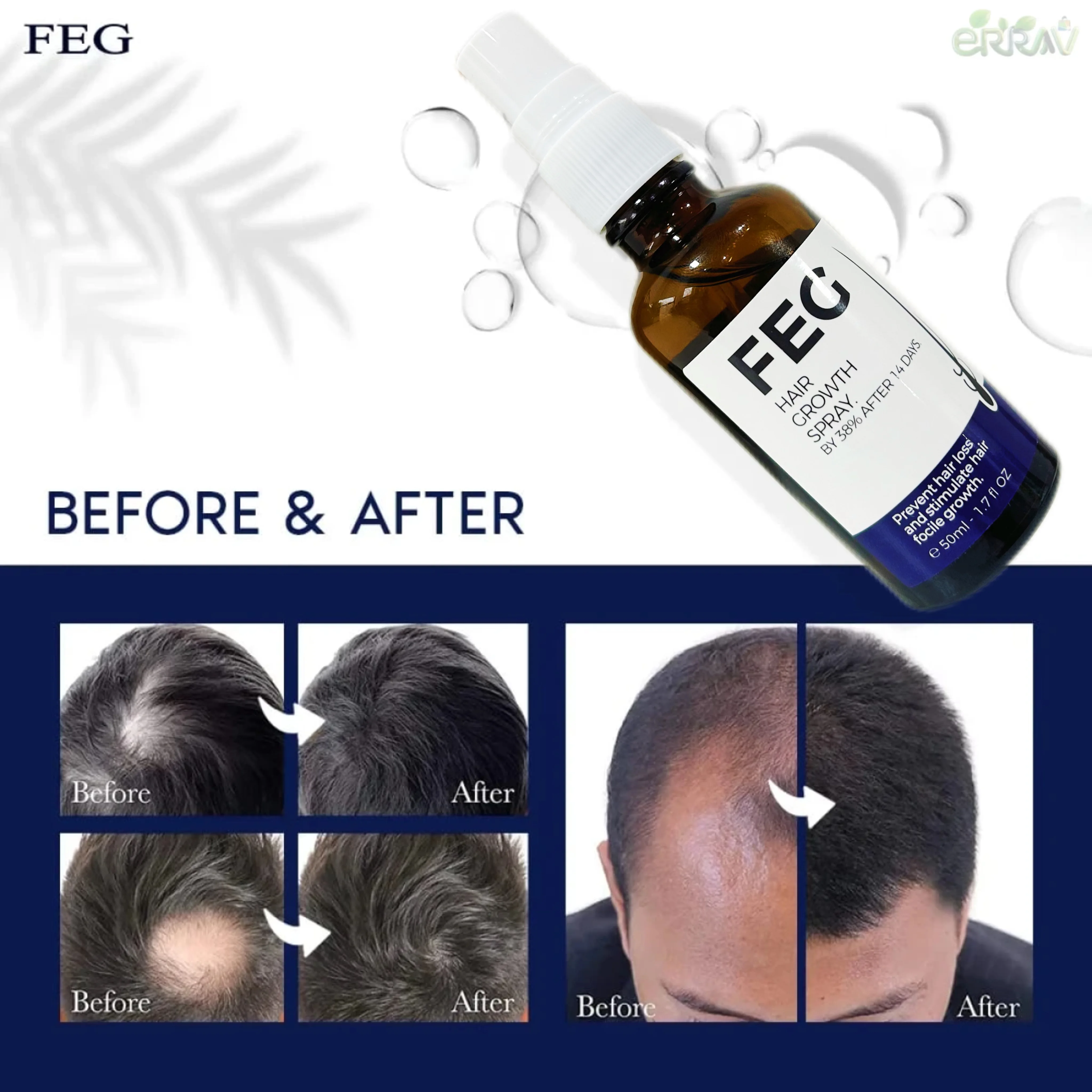 50mL FEG hair growth spray precent hair loss stimulate hair focile growth ownning Longer, thicker and healthier hair
50mL FEG hair growth spray precent hair loss stimulate hair focile growth ownning Longer, thicker and healthier hair