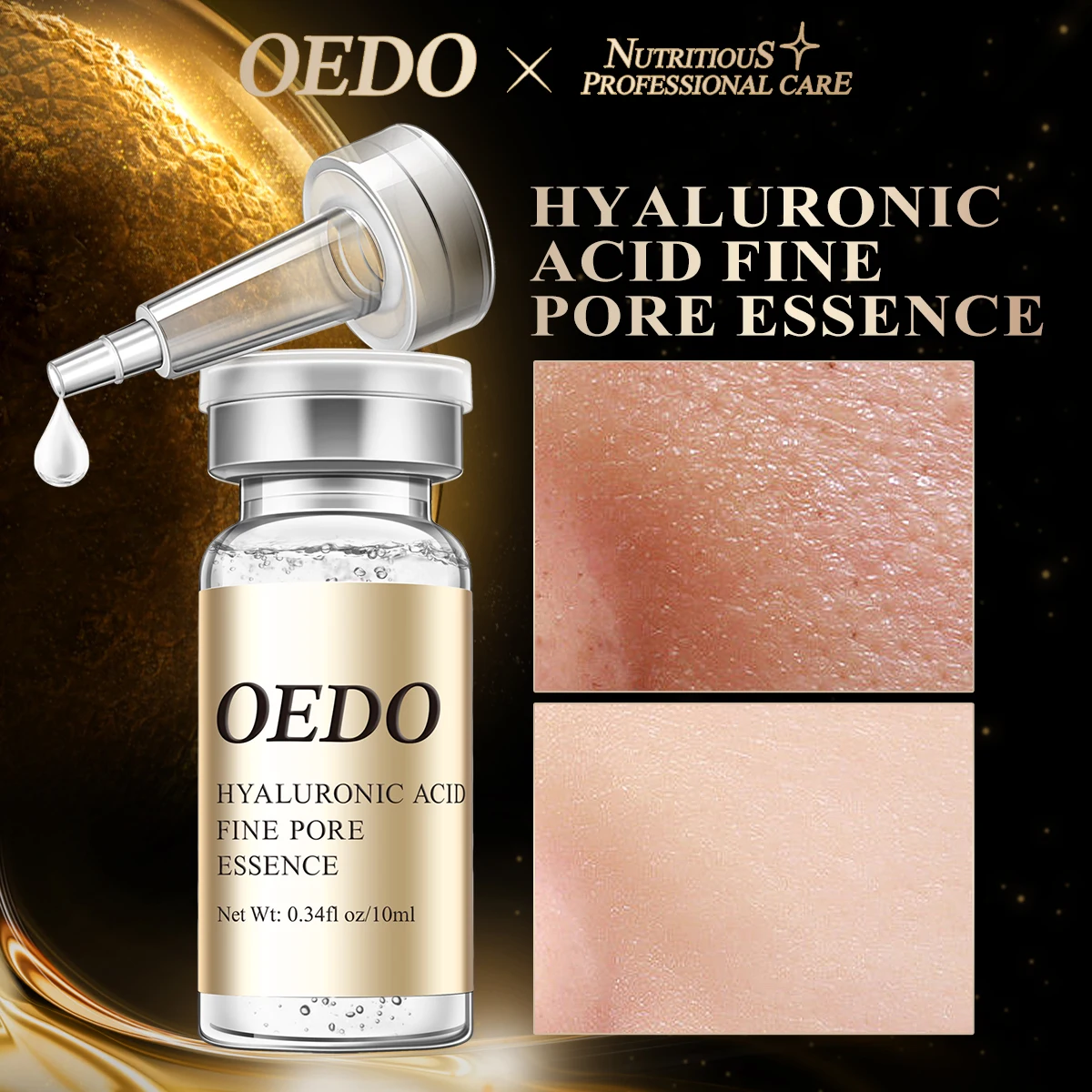 Pore Refining Essence Shrinks Pores Smooths Pores Reduces Fine Lines Removes Spots Whitens Moisturizes Anti-Aging Face Care
Pore Refining Essence Shrinks Pores Smooths Pores Reduces Fine Lines Removes Spots Whitens Moisturizes Anti-Aging Face Care
