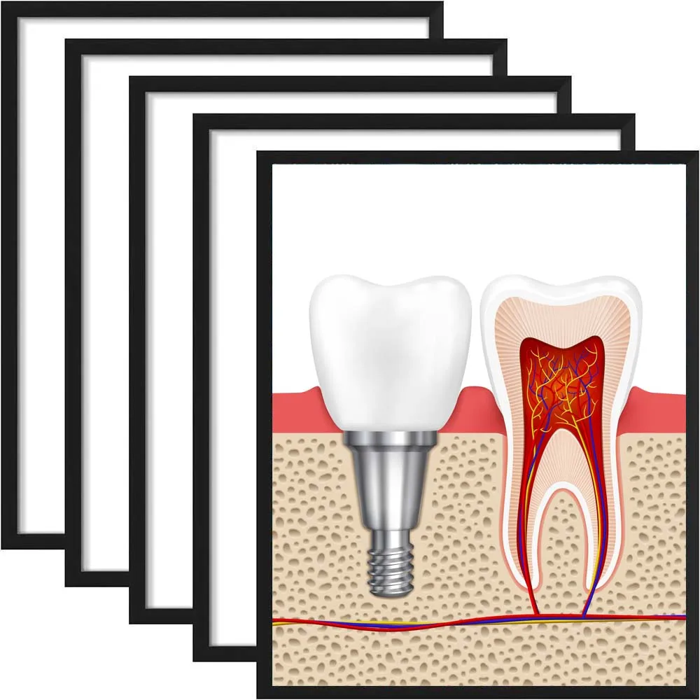 1pc 20X25 A4 A3 Wooden Photo Frame For Picture Rectangle Wall Pictures Frame Stand For Pictures Certificate Commemorative Gift
1pc 20X25 A4 A3 Wooden Photo Frame For Picture Rectangle Wall Pictures Frame Stand For Pictures Certificate Commemorative Gift