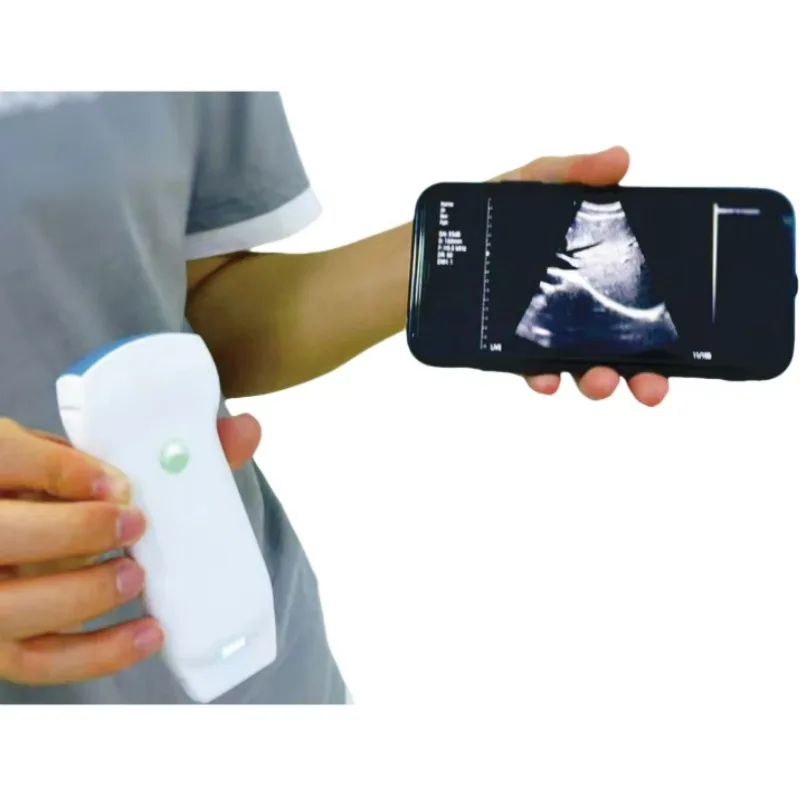 3 in 1 Wireless Doppler Veterinary Ultrasound Machines Double Head Convex Linear Phased Array Cardiac Probe for Clinic
3 in 1 Wireless Doppler Veterinary Ultrasound Machines Double Head Convex Linear Phased Array Cardiac Probe for Clinic