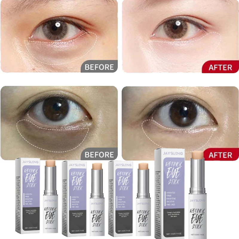 Retinol Eye Cream Stick Removes Eye Bags Reduces Dark Circles Anti-aging Wrinkles Moisturizes Nourishes The Eye Area Skin Care
Retinol Eye Cream Stick Removes Eye Bags Reduces Dark Circles Anti-aging Wrinkles Moisturizes Nourishes The Eye Area Skin Care