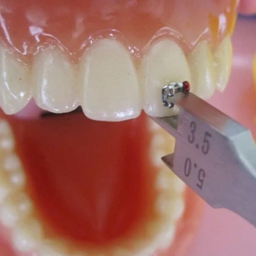 3 Piece Dental Bracket Locator Placement Gauge Precision Orthodontic Instrument for Accurate Bracket Positioning
3 Piece Dental Bracket Locator Placement Gauge Precision Orthodontic Instrument for Accurate Bracket Positioning