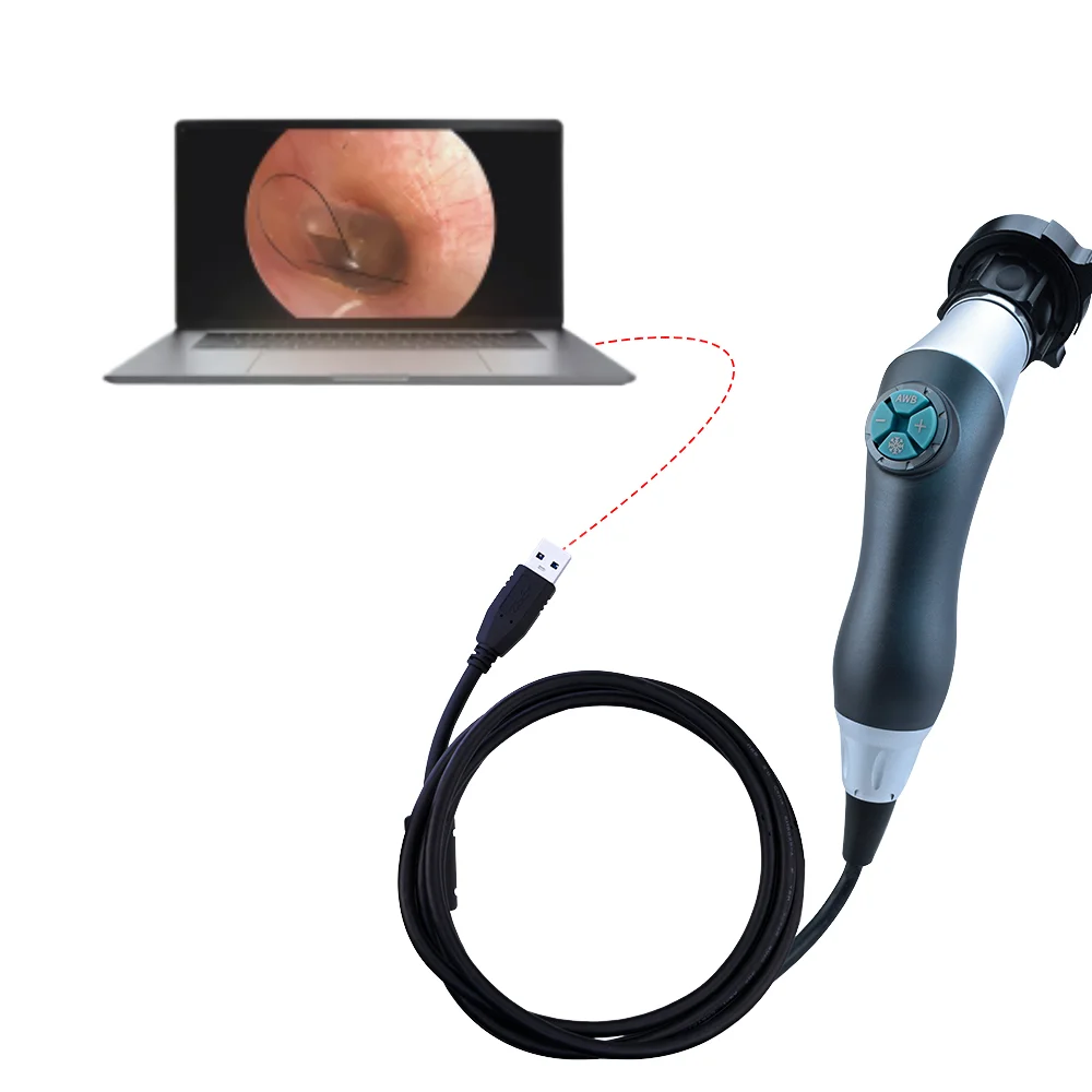 Medeasy Portable Metal Endoscope Camera System 1080p 60fps High Quality USB Camera with Optical Coupler
Medeasy Portable Metal Endoscope Camera System 1080p 60fps High Quality USB Camera with Optical Coupler