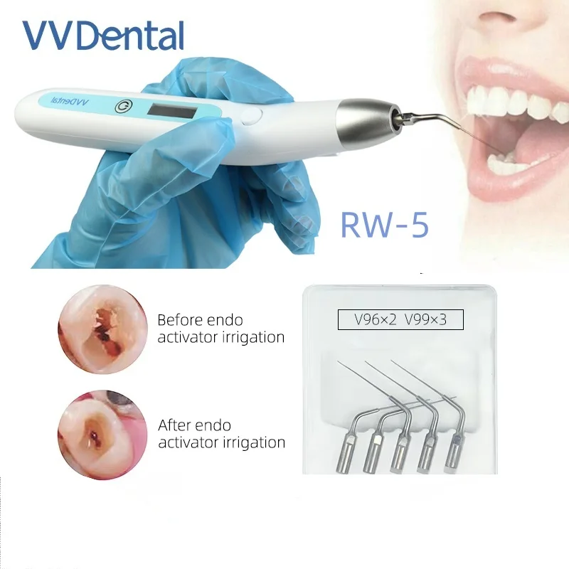 VVDental LED Wireless Ultrasonic Endo Activator Root with 5 Tips for Cleaning Teeth Canal Endodontic Irrigator Dentistry Lab
VVDental LED Wireless Ultrasonic Endo Activator Root with 5 Tips for Cleaning Teeth Canal Endodontic Irrigator Dentistry Lab