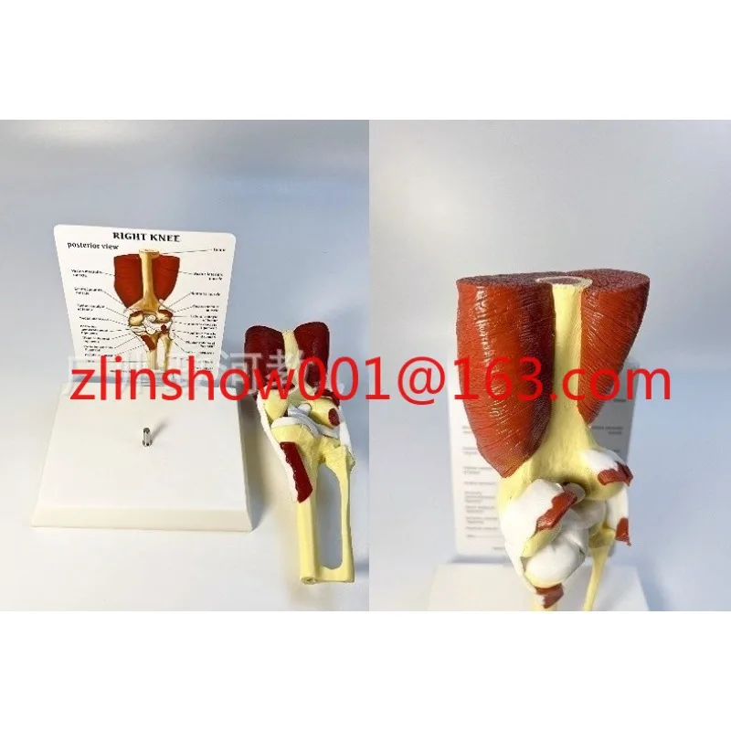 Human knee function model Human skeletal joint model Muscle knee joint Knee patella model
Human knee function model Human skeletal joint model Muscle knee joint Knee patella model