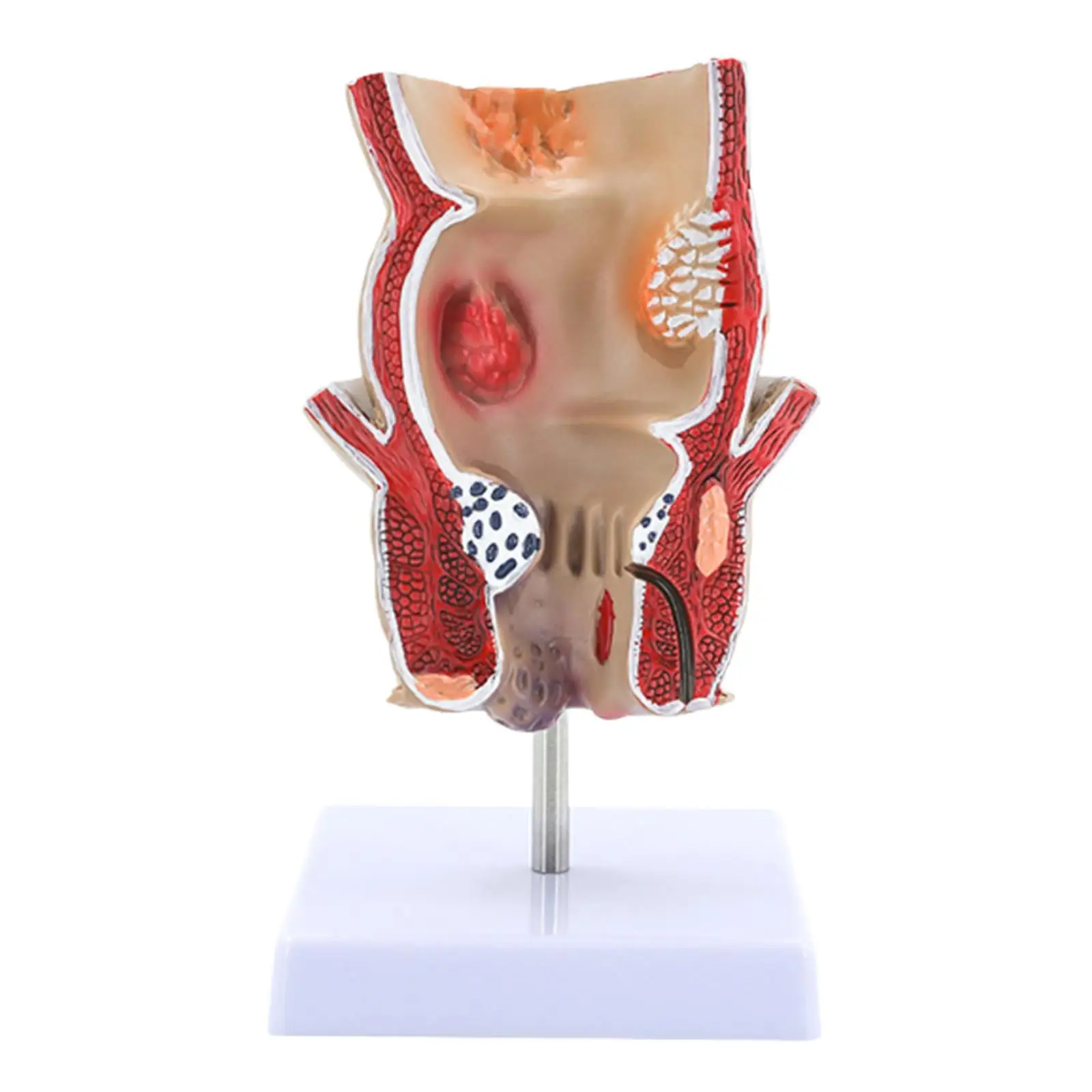 Human Pathological Rectal Model Professional Science Education Display Tool Teaching Tool for Research Classroom Learning Study
Human Pathological Rectal Model Professional Science Education Display Tool Teaching Tool for Research Classroom Learning Study