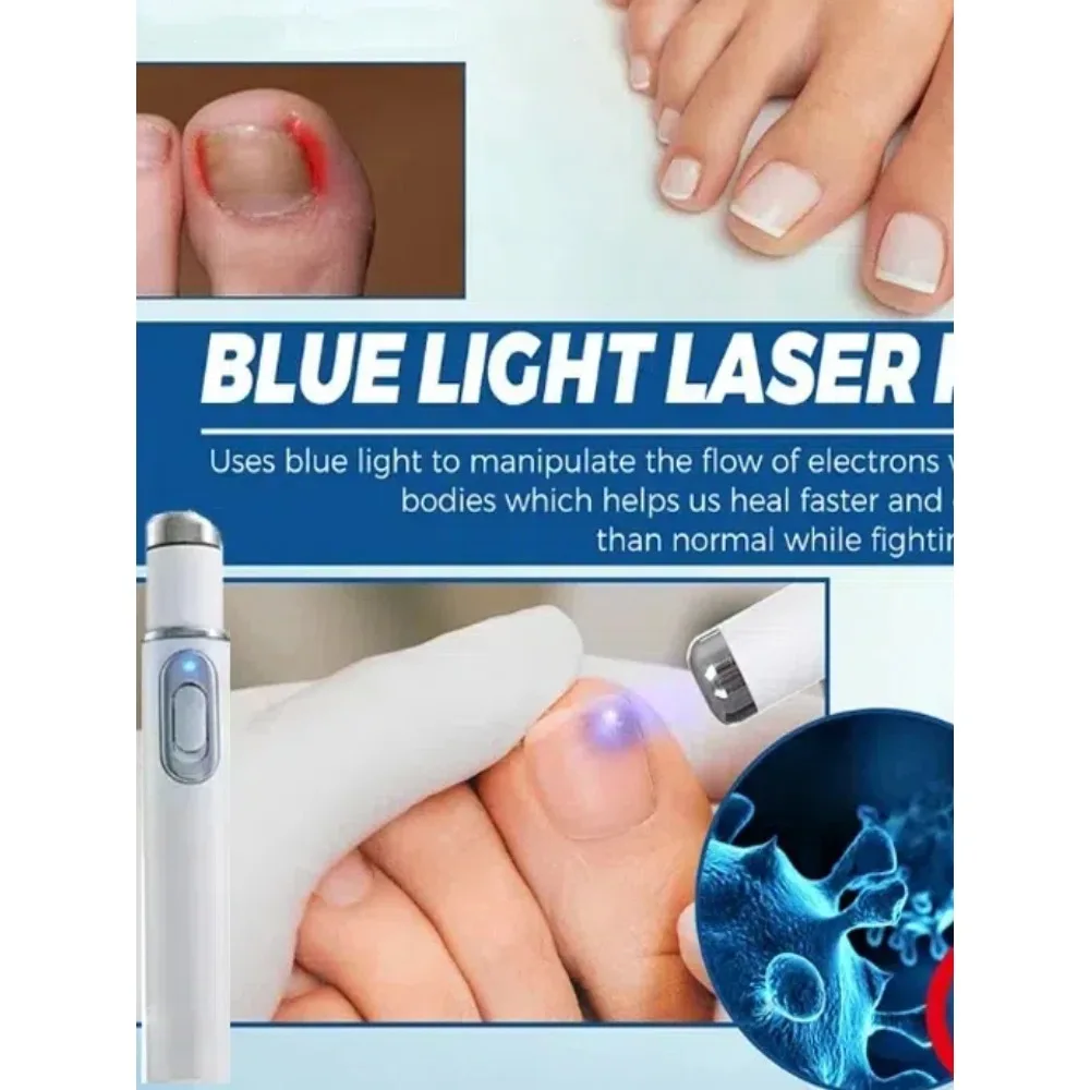 Профессиональная ручка от прыщей с синим светом — уменьшает разрыв пор и улучшает текстуру кожи лица
Профессиональная ручка от прыщей с синим светом — уменьшает разрыв пор и улучшает текстуру кожи лица