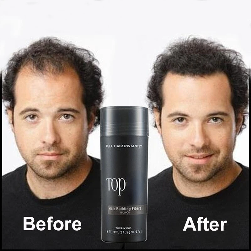 Hair Fibers Regrowth Powders Keratin Applicator Hair Building Fibers Spray Pump Growth Products Hair Care 27.5g
Hair Fibers Regrowth Powders Keratin Applicator Hair Building Fibers Spray Pump Growth Products Hair Care 27.5g