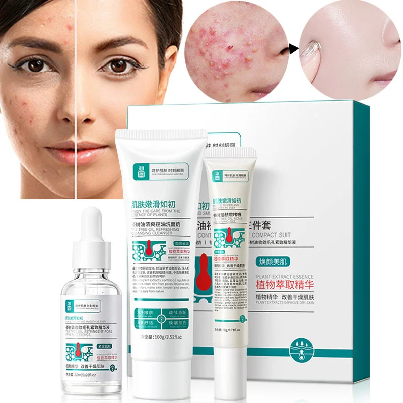 Acne Treatment Face Cream Tea Tree Serum Effectively Beat Acne-prone Skin Repairing Acne Spot Treatment Blackheads Acne Scar
Acne Treatment Face Cream Tea Tree Serum Effectively Beat Acne-prone Skin Repairing Acne Spot Treatment Blackheads Acne Scar