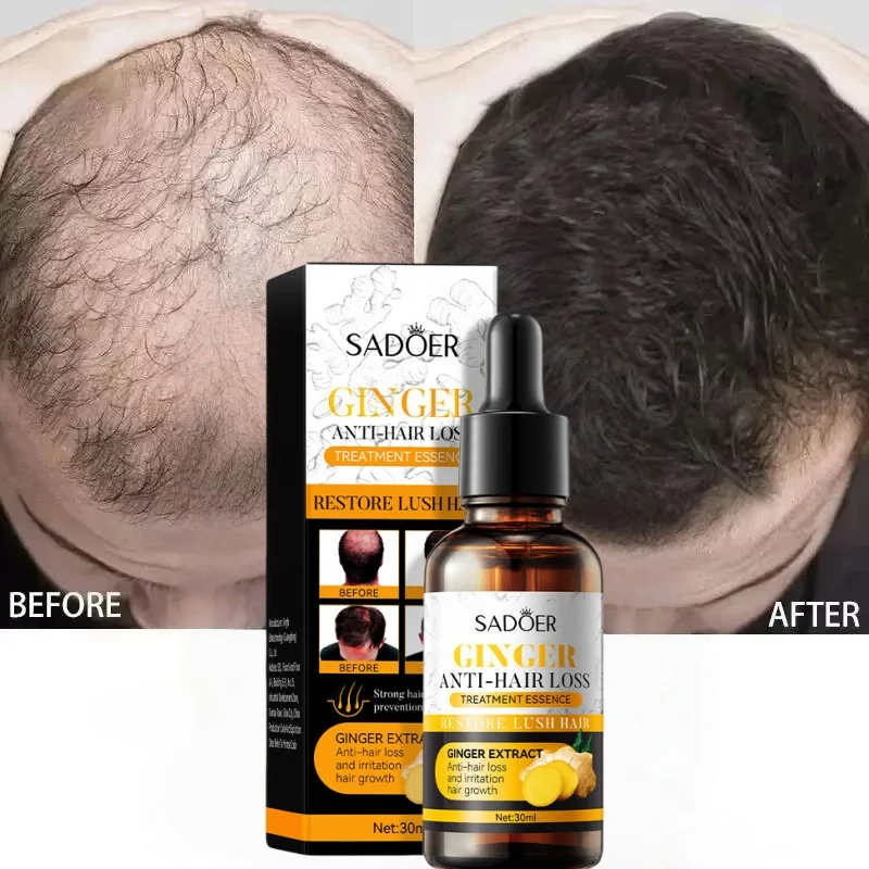 Ginger Hair Growth Serum Anti Hair Loss Fast Growth Strengthens Hair Light Weight Non Greasy Relief Hair Care For Women Men 
Ginger Hair Growth Serum Anti Hair Loss Fast Growth Strengthens Hair Light Weight Non Greasy Relief Hair Care For Women Men