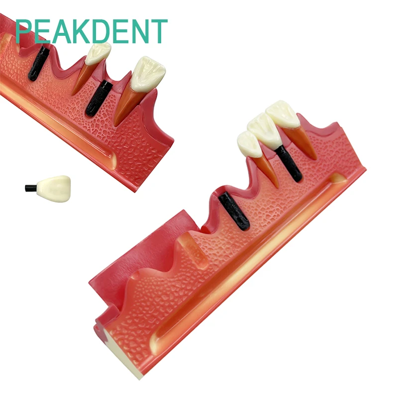 Учебная модель для демонстрации процедуры установки зубных имплантатов для обучения пациентов
Учебная модель для демонстрации процедуры установки зубных имплантатов для обучения пациентов