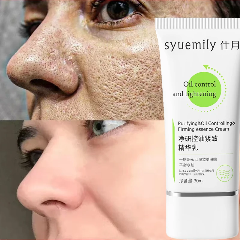 Salicylic Acid Pore Shrinking Cream Removing Large Pores Essence Oil Control Moisturizing Tighten Smooth Skin Care Cosmetics 30g
Salicylic Acid Pore Shrinking Cream Removing Large Pores Essence Oil Control Moisturizing Tighten Smooth Skin Care Cosmetics 30g