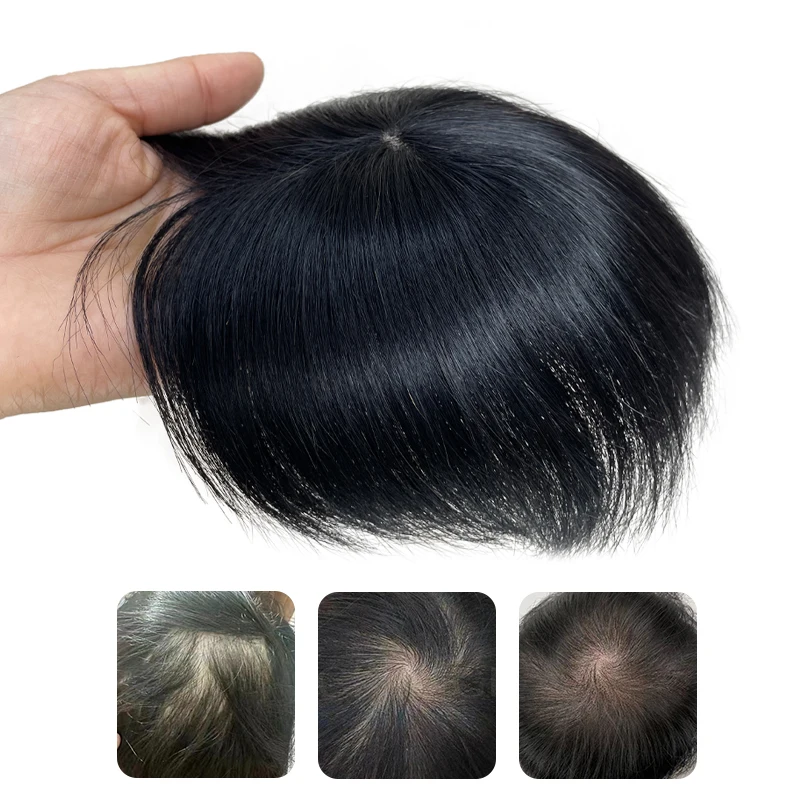 Mens Human Hair Natural Breathable Thinning Hair Cover-Up Top of The Head Balding Concealment Toupee Lace Pieces Wigs
Mens Human Hair Natural Breathable Thinning Hair Cover-Up Top of The Head Balding Concealment Toupee Lace Pieces Wigs