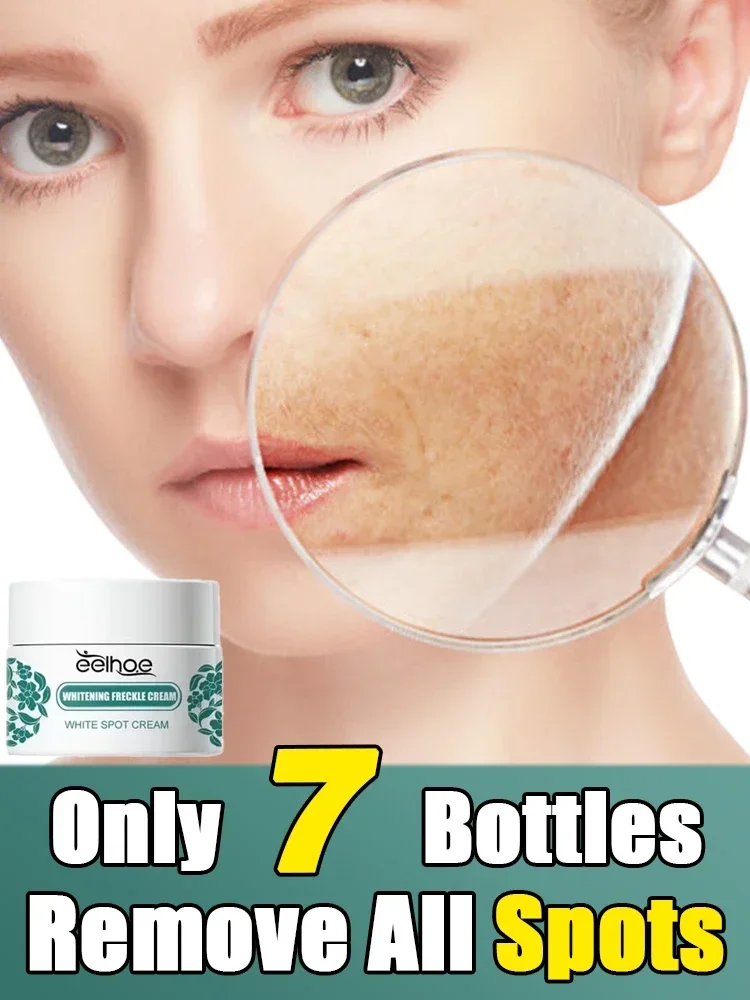 Removal Dark Spots Whitening Frckle Cream Brighten Facial Skin Firming Products Reduce Melanin Lighten Dark Skin
Removal Dark Spots Whitening Frckle Cream Brighten Facial Skin Firming Products Reduce Melanin Lighten Dark Skin