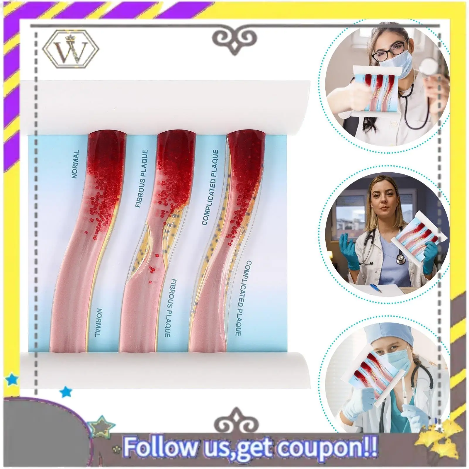 New Dynamic Blood Vessel Model Cardiovascular Blockage Contrast Model Thrombosis Model For Teaching Explanation
New Dynamic Blood Vessel Model Cardiovascular Blockage Contrast Model Thrombosis Model For Teaching Explanation