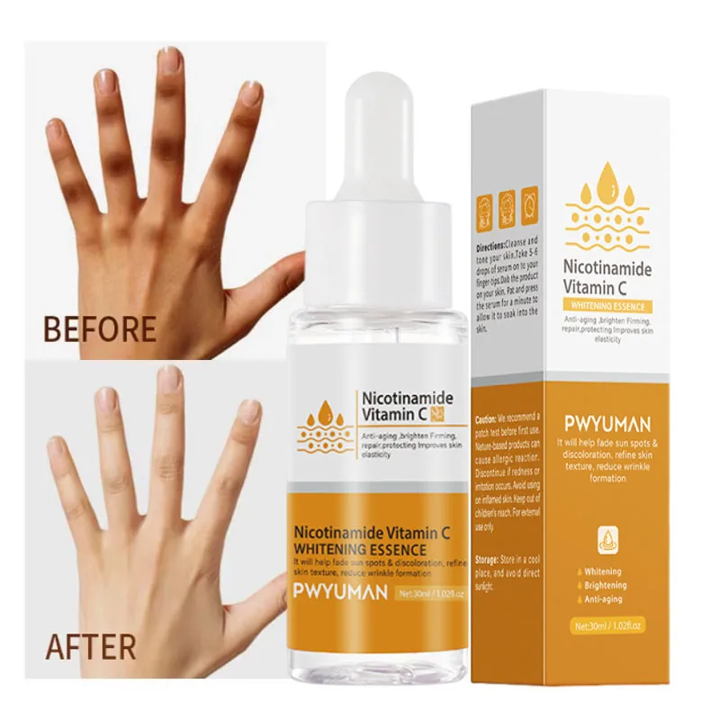 Dark Knuckles Fast Brighten Serum Elbows Hand Knuckle Brightening Serum Knee Black Skin Quickly Lighten Stains Remover Essence
Dark Knuckles Fast Brighten Serum Elbows Hand Knuckle Brightening Serum Knee Black Skin Quickly Lighten Stains Remover Essence