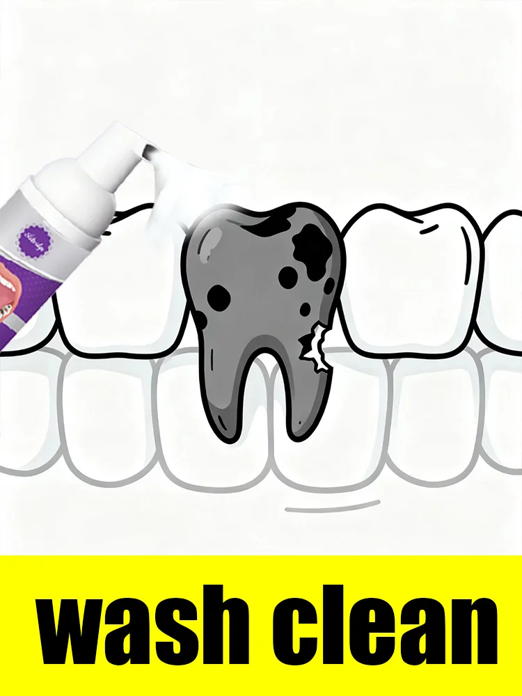 Foam mousse for cleaning rotten discoloration defects
Foam mousse for cleaning rotten discoloration defects