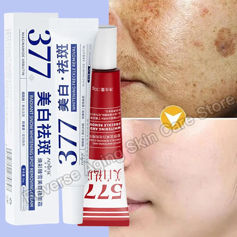 Whitening Spot Removal Cream Niacinamide Dark Spot Corrector Face Cream Melasma Freckle Sun Spot Remover Brighten Anti-Aging 30g
Whitening Spot Removal Cream Niacinamide Dark Spot Corrector Face Cream Melasma Freckle Sun Spot Remover Brighten Anti-Aging 30g